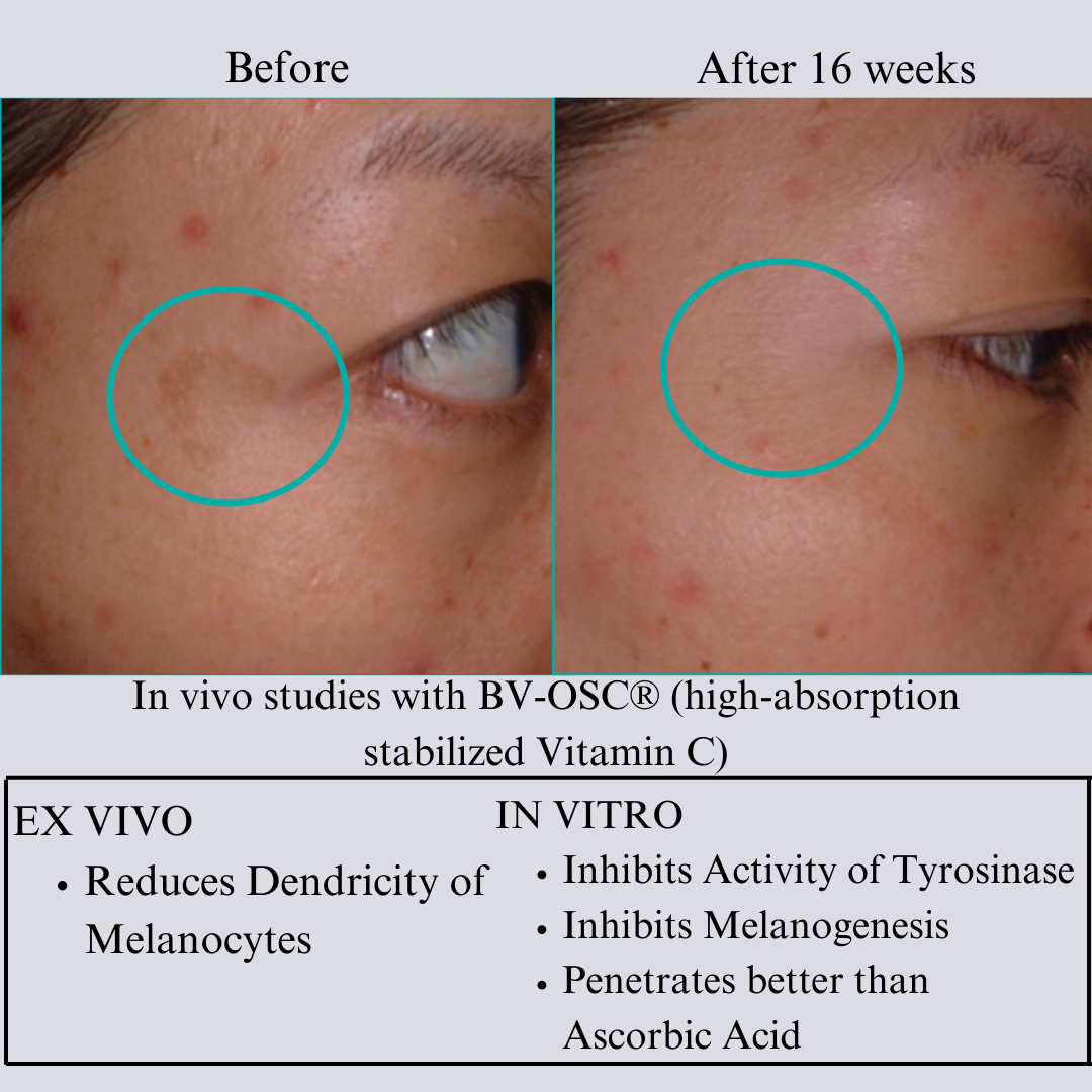 Tight & Bright Phyto-Retinol + Vitamin C Face Serum